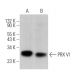 PRX VI Antibody (36) - Western Blotting - Image 363446 