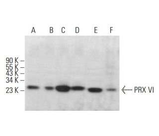 PRX VI Antibody (36) - Western Blotting - Image 382150 