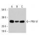 PRX VI 抗体 (A-11):sc -393024。通过蛋白质印迹分析 HeLa (A)、K-562 (B) 和 HCT-116 (C) 完整细胞裂解物中 PRX VI 的表达。使用的检测试剂:m-IgG Fc BP-HRP:sc-525409。 PRX VI Antibody (A-11) - Western Blotting - Image 415199