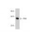 PRX1 Antibody (1E2) - Western Blotting - Image 384249 