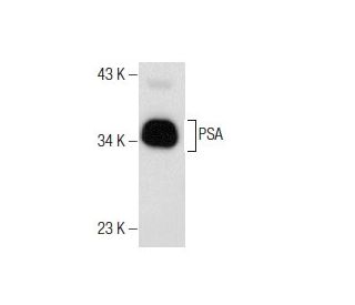 PSA/KLK3/Kallikrein 3/Prostate Specific Antigen Antibody (A67-B/E3) - Western Blotting - Image 158432 