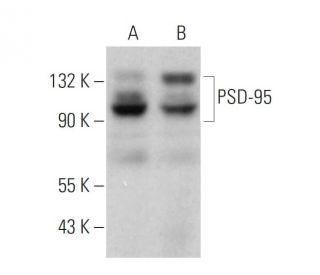 PSD-95 Antibody (2Q129) - Western Blotting - Image 377308