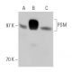 PSM Antibody (Y-PSMA2) - Western Blotting - Image 31010