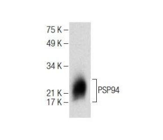 PSP94 Antibody (G-6) - Western Blotting - Image 284509