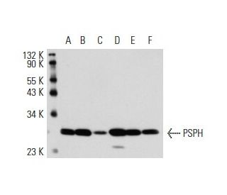 PSPH Antibody (3G12) - Western Blotting - Image 17769 