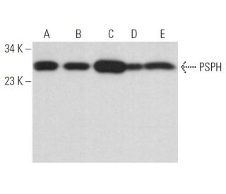 PSPH Antibody (H-11) - Western Blotting - Image 365200 