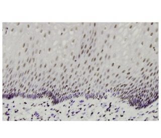 PTF1 Antibody (43B-9) - Immunohistochemistry - Image 35948