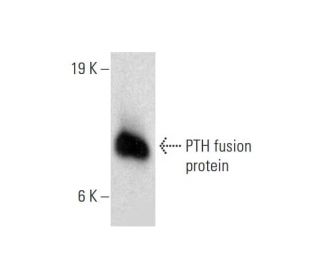 PTH Antibody (2B67) - Western Blotting - Image 144641