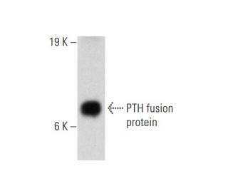 PTH Antibody (5A7) - Western Blotting - Image 144642