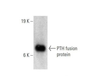 PTH Antibody (5E745) - Western Blotting - Image 144640