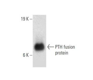 PTH Antibody (D1.1) - Western Blotting - Image 144638