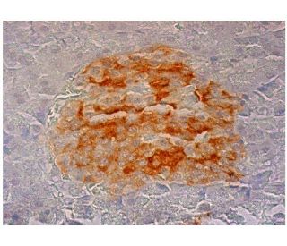 PTP IA-2 Antibody (98/4H6) - Immunohistochemistry - Image 301752 