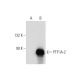 PTP IA-2 Antibody (98/4H6) - Western Blotting - Image 130101