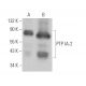 PTP IA-2 Antibody (A-5) - Western Blotting - Image 370110
