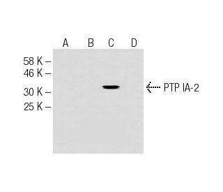 PTP IA-2 Antibody (AFT38) - Western Blotting - Image 62778 