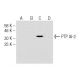 PTP IA-2 Antibody (AFT38) - Western Blotting - Image 62778 