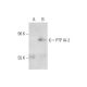 PTP IA-2 Antibody (AFT38) - Western Blotting - Image 130099