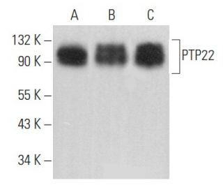 PTP22 Antibody (E-5) - Western Blotting - Image 357126Each CRISPR/Cas9 Knockout (KO) Plasmid product consists of a pool of 3 plasmids designed to ensure identification and cleavage of a specific gene for maximum knockout efficiency. Each plasmid encodes a unique 20 nt sequence derived from the GeCKO (v2) library.