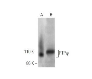 PTP&psi; Antibody (E-2) - Western Blotting - Image 292078