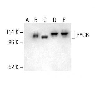 PYGB Antibody (B-5) - Western Blotting - Image 411854 