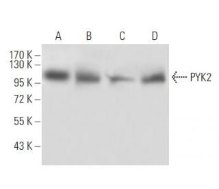 PYK2 Antibody (5E2D5) - Western Blotting - Image 137480 