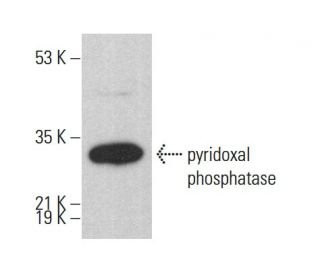pyridoxal phosphatase Antibody (B-3) - Western Blotting - Image 378481 