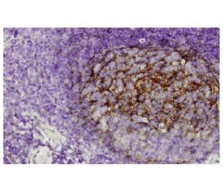 QAPRTase Antibody (ZN-17) - Immunohistochemistry - Image 36169 