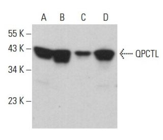 QPCTL Antibody (B-3) - Western Blotting - Image 379475 