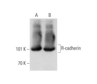 R-cadherin Antibody (48) - Western Blotting - Image 143616 