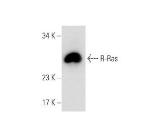 R-Ras Antibody (C-8) - Western Blotting - Image 70286SAM Transcription Activation: SAM system utilizing dCas9-VP64, MS2-P65-HSF1, and sgRNA for precise gene transcription activation.