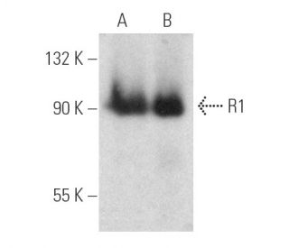 R1 Antibody (E-7) - Western Blotting - Image 389384SAM Transcription Activation: SAM system utilizing dCas9-VP64, MS2-P65-HSF1, and sgRNA for precise gene transcription activation.