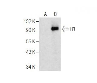 R1 Antibody (E-7) - Western Blotting - Image 284426
