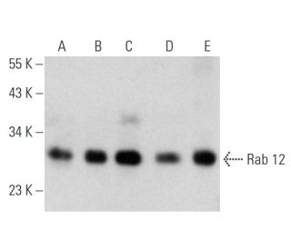 Rab 12 Antibody (H-11) - Western Blotting - Image 353673 