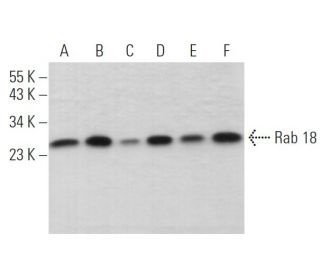 Rab 18 Antibody (D-5) - Western Blotting - Image 373555Each CRISPR/Cas9 Knockout (KO) Plasmid product consists of a pool of 3 plasmids designed to ensure identification and cleavage of a specific gene for maximum knockout efficiency. Each plasmid encodes a unique 20 nt sequence derived from the GeCKO (v2) library.
