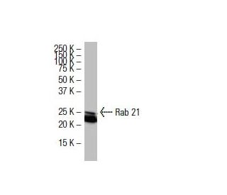 Rab 21 Antibody (B16K) - Western Blotting - Image 33568 