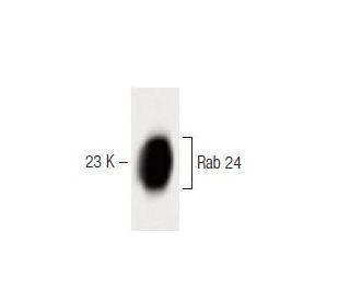 Rab 24 Antibody (43) - Western Blotting - Image 60452 