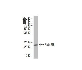 Rab 2B Antibody (139.1) - Western Blotting - Image 33572 