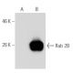 Rab 2B Antibody (139.1) - Western Blotting - Image 50828 