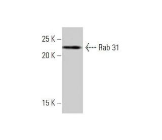 Rab 31 Antibody (4D12) - Western Blotting - Image 352181 