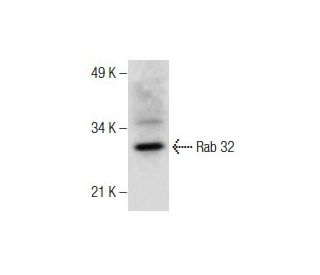 Rab 32 Antibody (B-11) - Western Blotting - Image 286889 