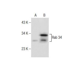 Rab 34 Antibody (H-6) - Western Blotting - Image 160490 