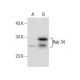 Rab 34 Antibody (H-6) - Western Blotting - Image 160490 