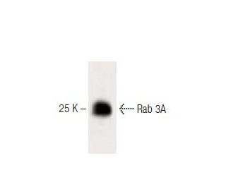 Rab 3A Antibody (9) - Western Blotting - Image 60425 