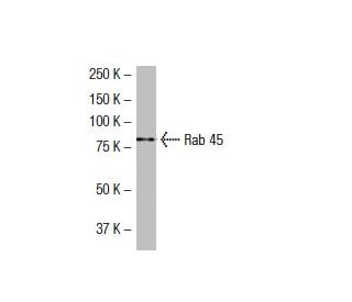 Rab 45 Antibody (SJ-12) - Western Blotting - Image 33576Each CRISPR/Cas9 Knockout (KO) Plasmid product consists of a pool of 3 plasmids designed to ensure identification and cleavage of a specific gene for maximum knockout efficiency. Each plasmid encodes a unique 20 nt sequence derived from the GeCKO (v2) library.
