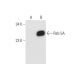 Rab 5A Antibody (D-2) - Western Blotting - Image 63060 