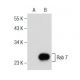 Rab 7 Antibody (D-4) - Western Blotting - Image 134779 
