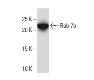 Rab 7b Antibody (JK-17) - Western Blotting - Image 33573 