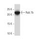 Rab 7b Antibody (JK-17) - Western Blotting - Image 33573 