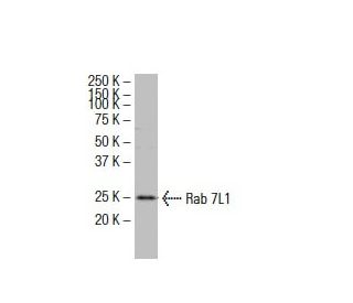 Rab 7L1 Antibody (31-E) - Western Blotting - Image 33575 