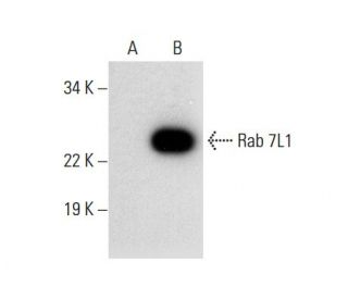 Rab 7L1 Antibody (D-8) - Western Blotting - Image 303482 